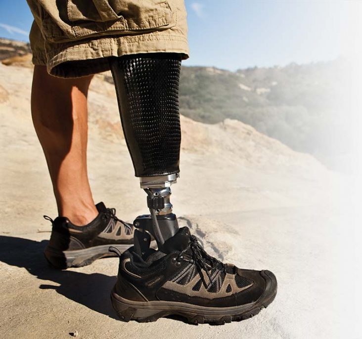 Prosthetics - Bio Dynamic Technologies